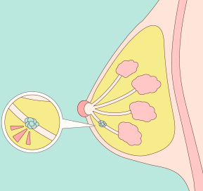 難治療的特殊類型乳癌：三陰性乳癌｜台中婦產科｜西屯區安笙婦產科